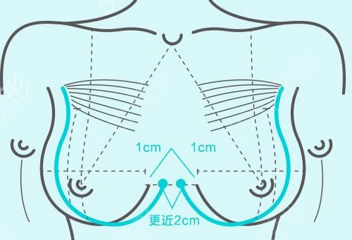 深圳隆胸正規(guī)的醫(yī)院排行榜名單揭秘