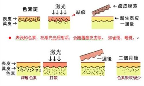 上海*祛斑比较好的医院排行榜