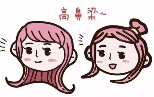 郑州做隆鼻手术哪里比较好