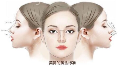 郑州做隆鼻手术哪里比较好