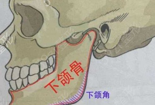 长沙下颌角磨骨哪家医院好
