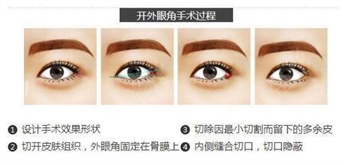 石家莊260醫(yī)院整形科怎么樣