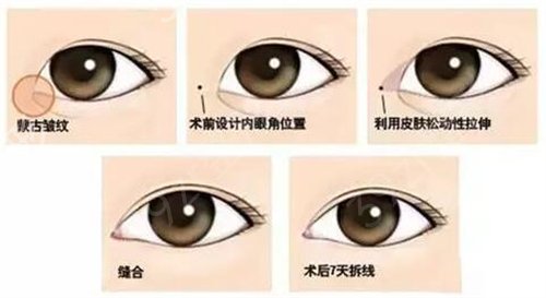 石家莊260醫(yī)院整形科怎么樣