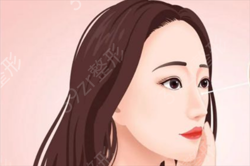 2022上海鼻头整形哪家好