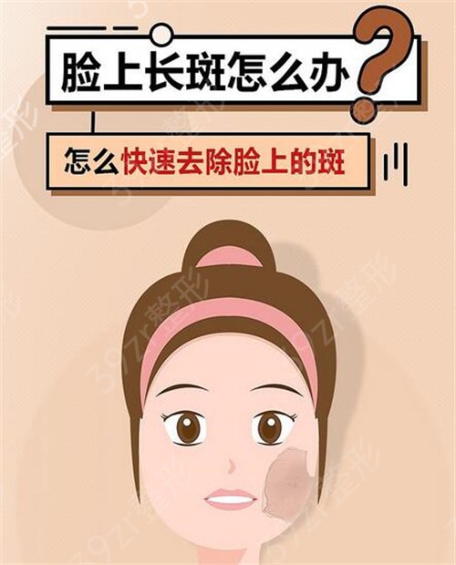 上海*祛斑比较好的医院排行榜
