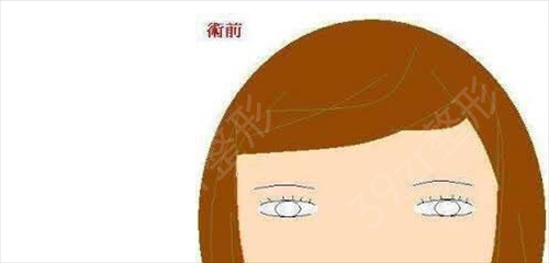南充割双眼皮医院哪家好
