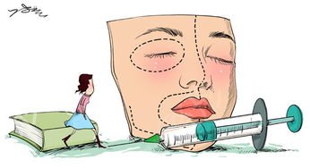 孝感天妃醫(yī)療整形美容門(mén)診部全切雙眼皮案例