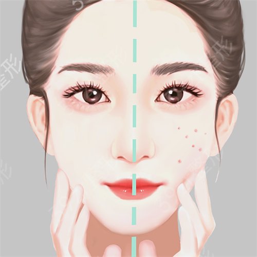伊美尔黑脸娃娃做完后皮肤又嫩又白