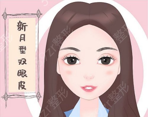 昆明双眼皮医院医生排行榜