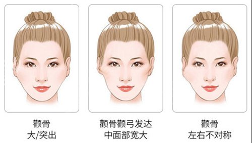 上海港华医院有磨骨资质吗