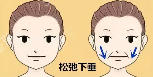 昆明做热玛吉医院哪家好