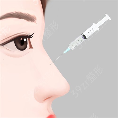 杭州哪個(gè)醫(yī)院美容科隆鼻比較好