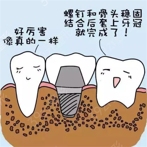 无锡种植牙医院哪里比较好