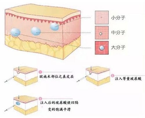 二炮总医院整形科价格表2022一览