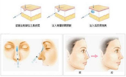 二炮总医院整形科价格表2022一览