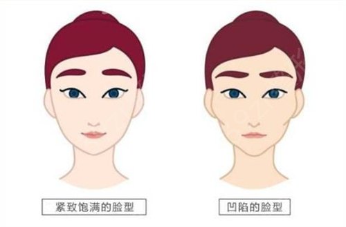 成都自體脂肪填充哪家醫(yī)院好