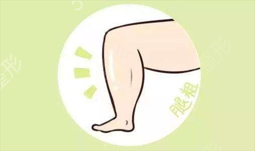 吸脂减肥北京哪家好