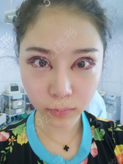 北京擅长双眼皮医院前十名公布