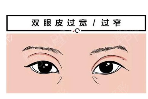 北京美莱整形医院价格表_眼部手术案例_专家介绍_北京美莱整形收费明细