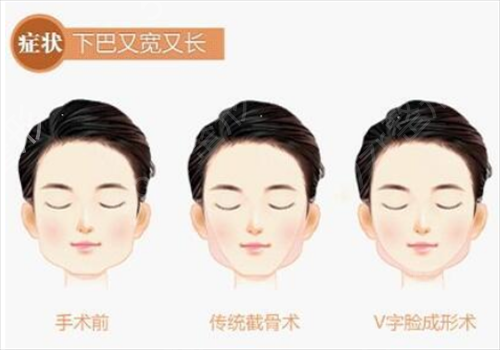 北京三甲医院整形科排名榜前五权威点评