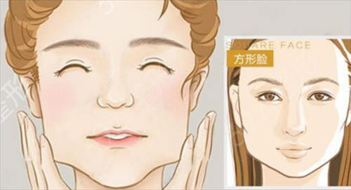 成都下颌角比较好的医院有哪些