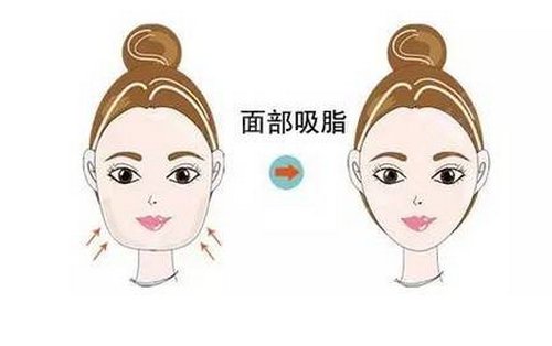 九院吸脂医生哪位好
