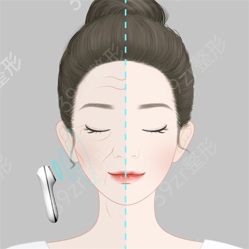 常熟时代医疗美容门诊部体验一次复合彩光嫩肤
