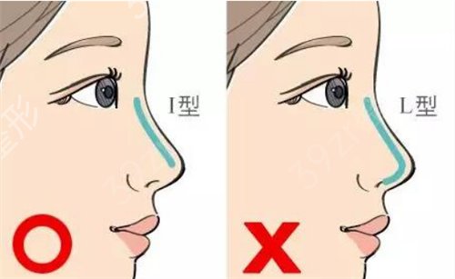 深圳隆鼻整形医院排行榜*_2022手术价格及口碑案例新流出