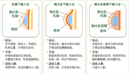 廣州整形醫(yī)院排名前三2022新排名公布