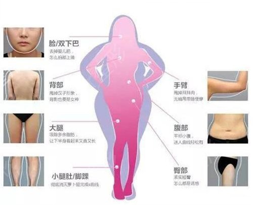 广州吸脂手术医院排名榜公布_前三强哪个好