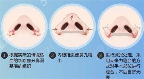 除了上海九院