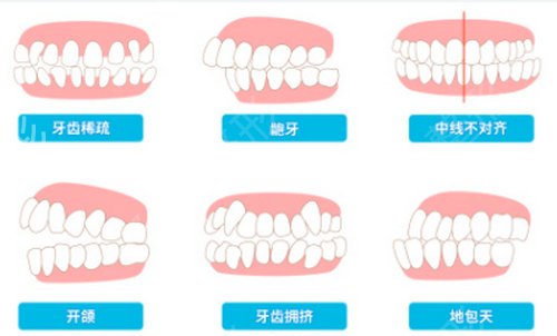正颌手术北京哪里做得好