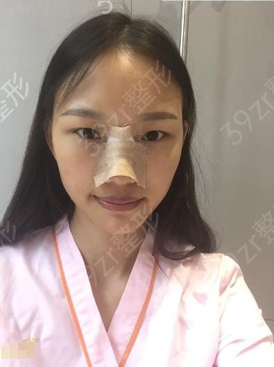佛山隆鼻整容哪家好