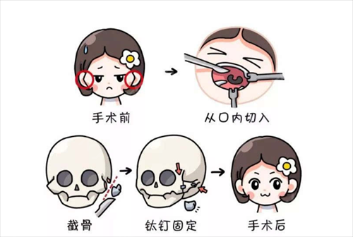 北京磨骨有名的专家排行榜名次查询