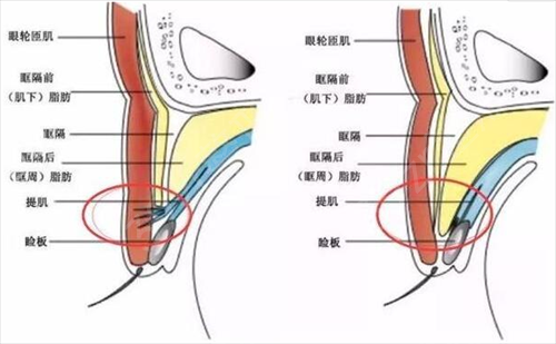 2022深圳双眼皮医生排名榜前四热门推荐
