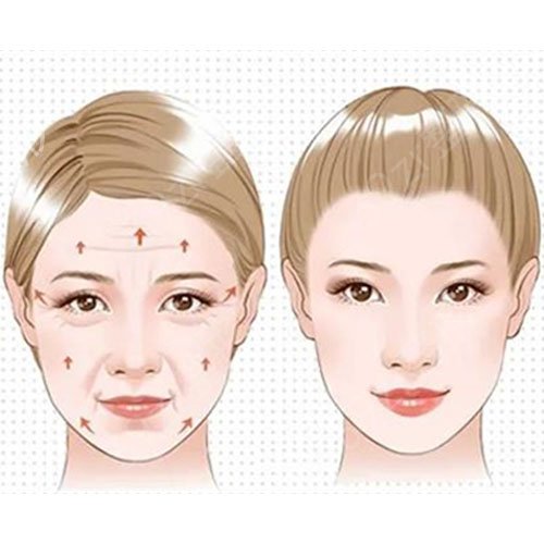 北京拉皮手術(shù)醫(yī)院口碑前十