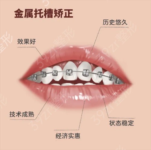 绍兴市人民医院整形外科_怎么样_整牙案例