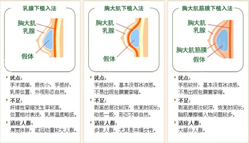 深圳市宝安区人民医院是三甲吗