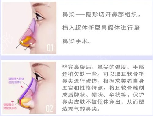 上海有名气的鼻王哪个好