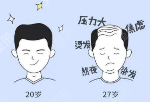 广州植发机构排名榜前三强揭秘