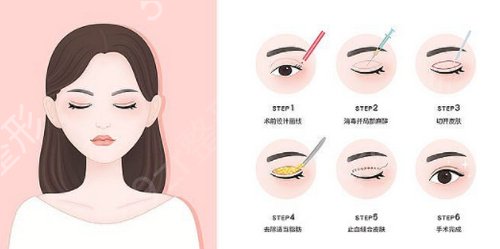 郑州做双眼皮哪家医院专业好