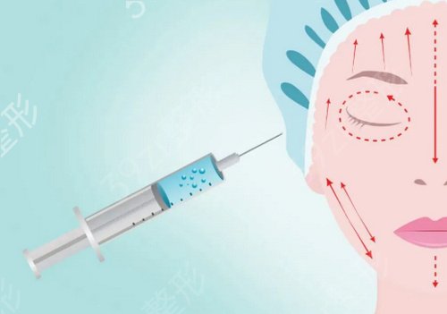 深圳哪家公立医院脂肪填充好