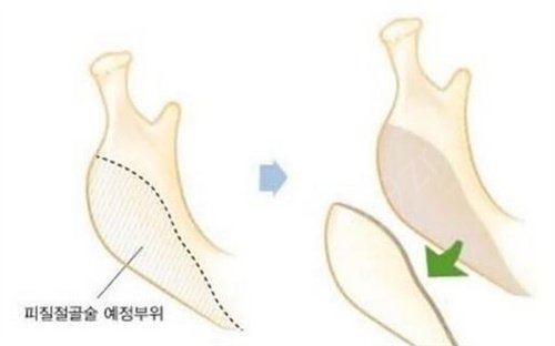 杭州排名前三的整形医院哪家好