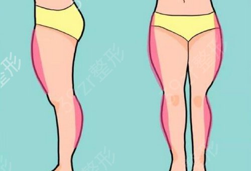 廣州吸脂醫(yī)生排名推薦
