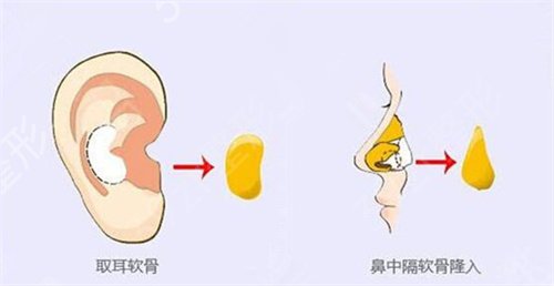 上海有名气的鼻王哪个好