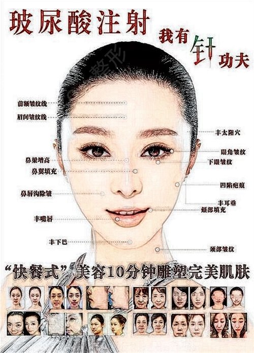 国内权威的整形医院是哪家