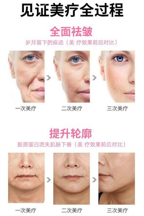 国内权威的整形医院是哪家
