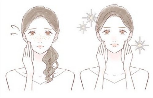 去重慶天妃整形美容醫(yī)院祛斑后