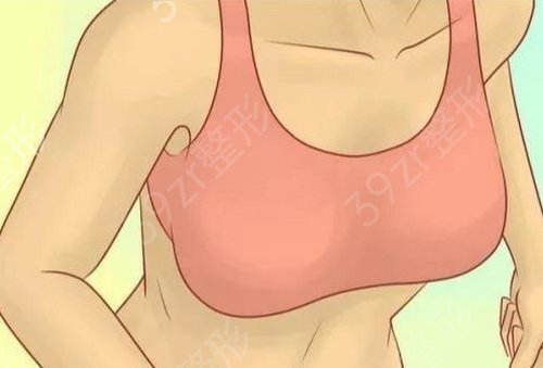 上海九院余力隆胸怎么样