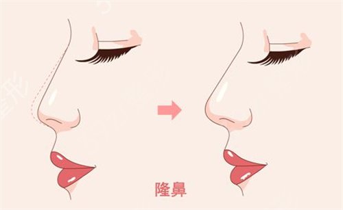 東莞整形醫(yī)院排行榜哪家比較好